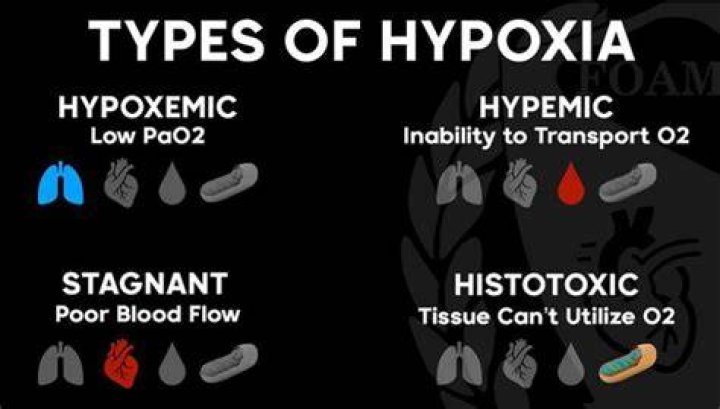 what are the 4 types of hypoxia?