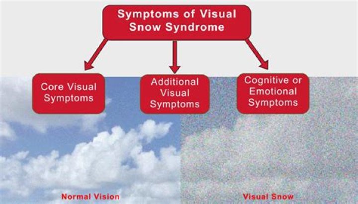 what causes it to snow