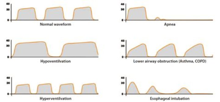 what causes the tidal bulges to form?