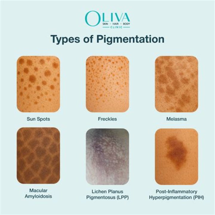 what color does a pigment absorb