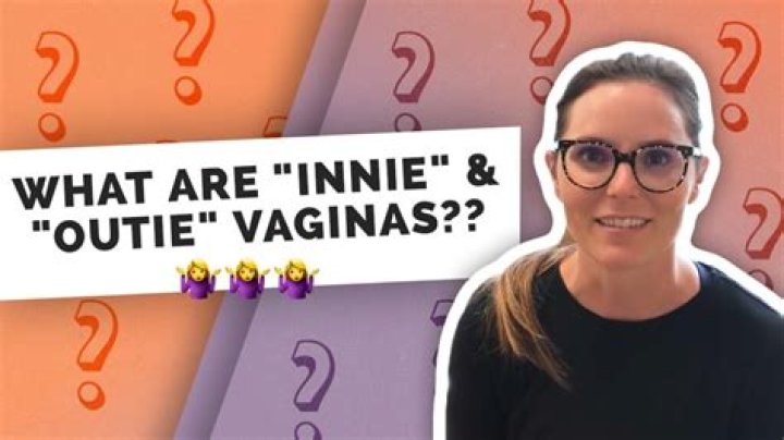 what determines innie or outie
