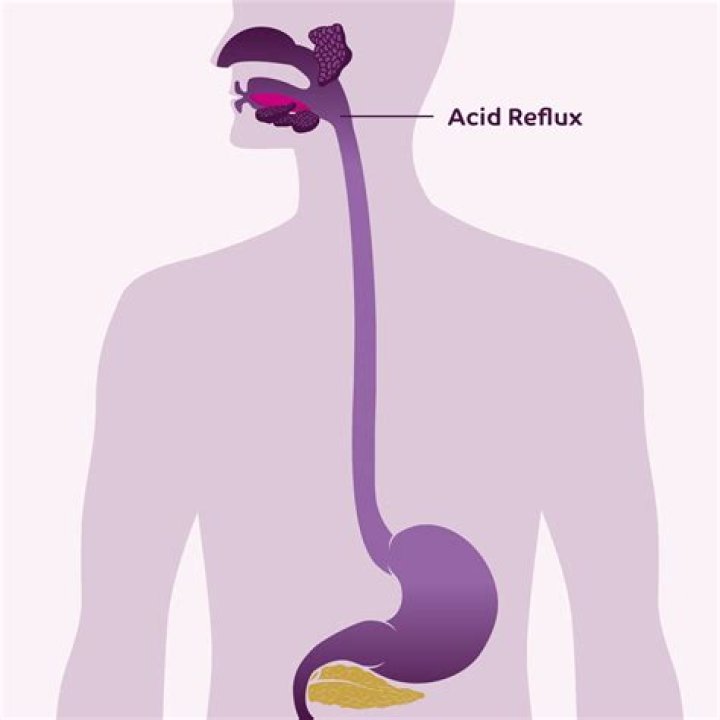 what does an acid release when it is dissolved