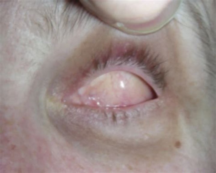 what does an eye socket look like
