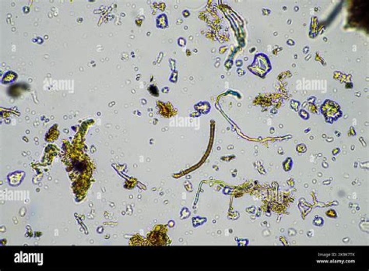 what does fungus look like under a microscope