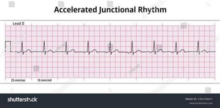 what does rhythm in a pattern indicate