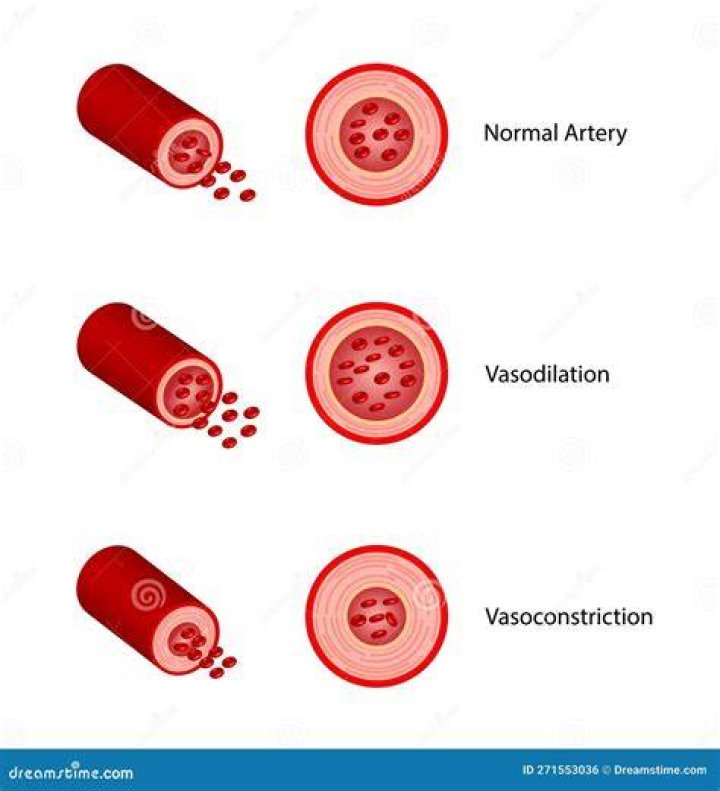 what is constriction - Lisbd-net.com